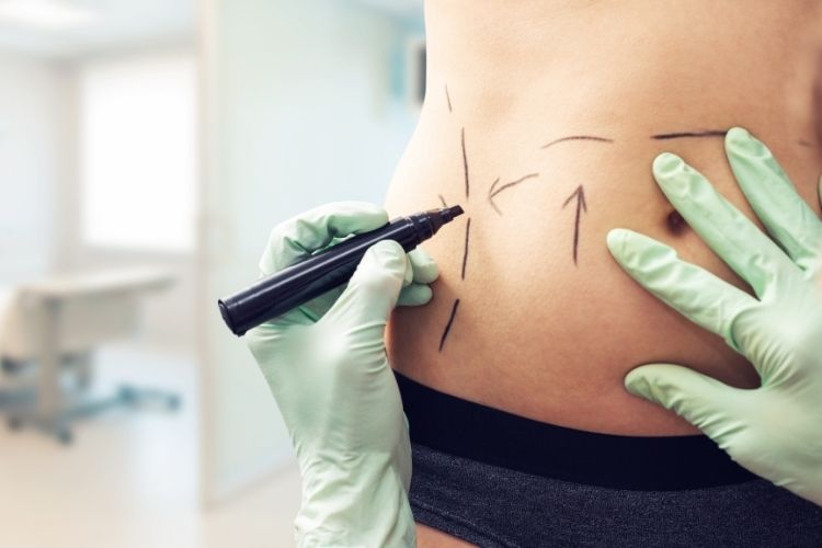 risks tummy tuck arlington