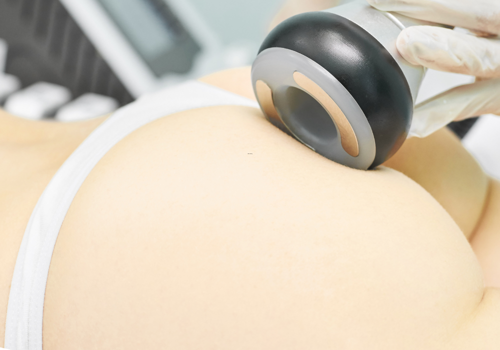 best cellulite reduction options McLean
