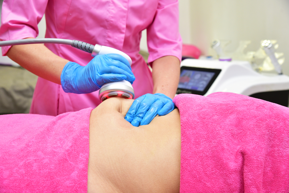 cellulite treatments in Alexandria and Shirlington VA