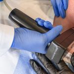 treat jowls in Arlington with Morpheus8 RF microneedling