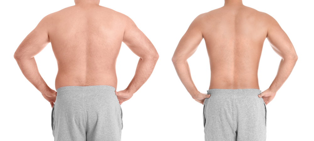 showing off results of Morpheus8 for men in Arlington VA
