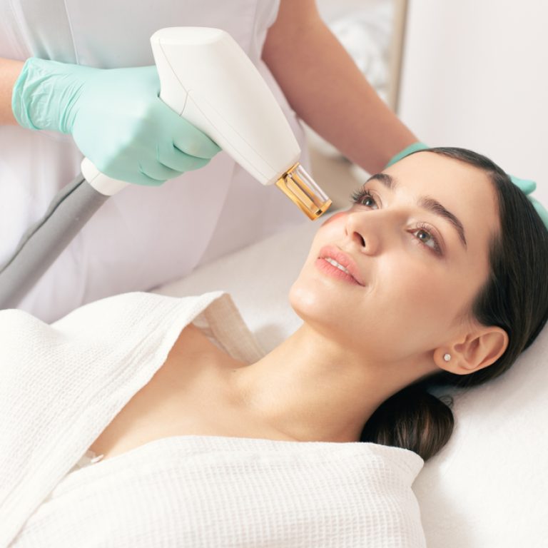 woman getting CO2 laser tightening in Northern Virginia