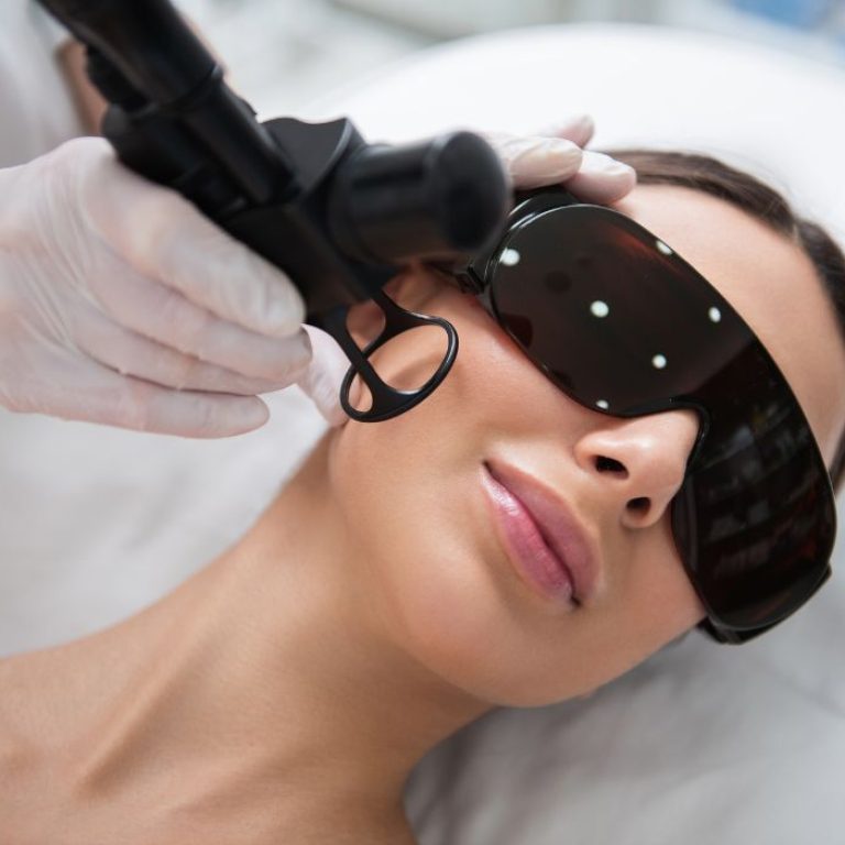 CO2 laser wrinkle treatment Arlington