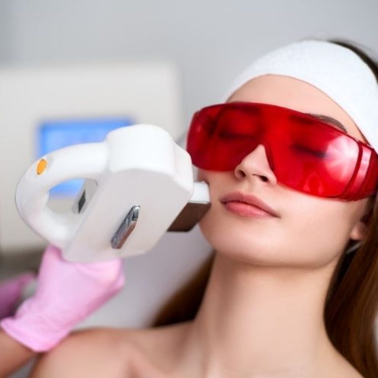 IPL skin tightening arlington