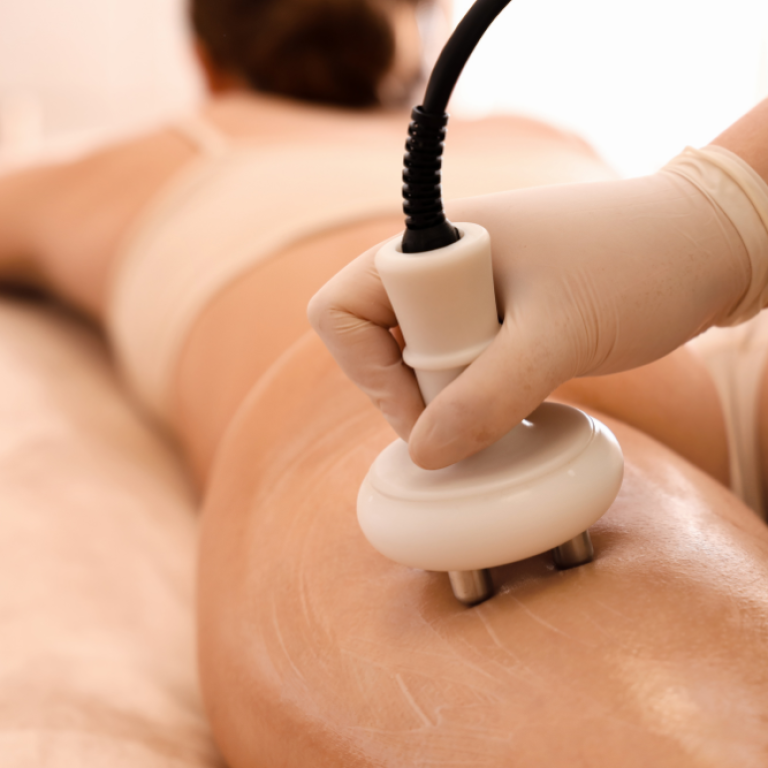 affordable cellulite treatment Tysons Corner