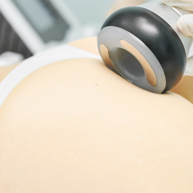 best cellulite reduction options McLean