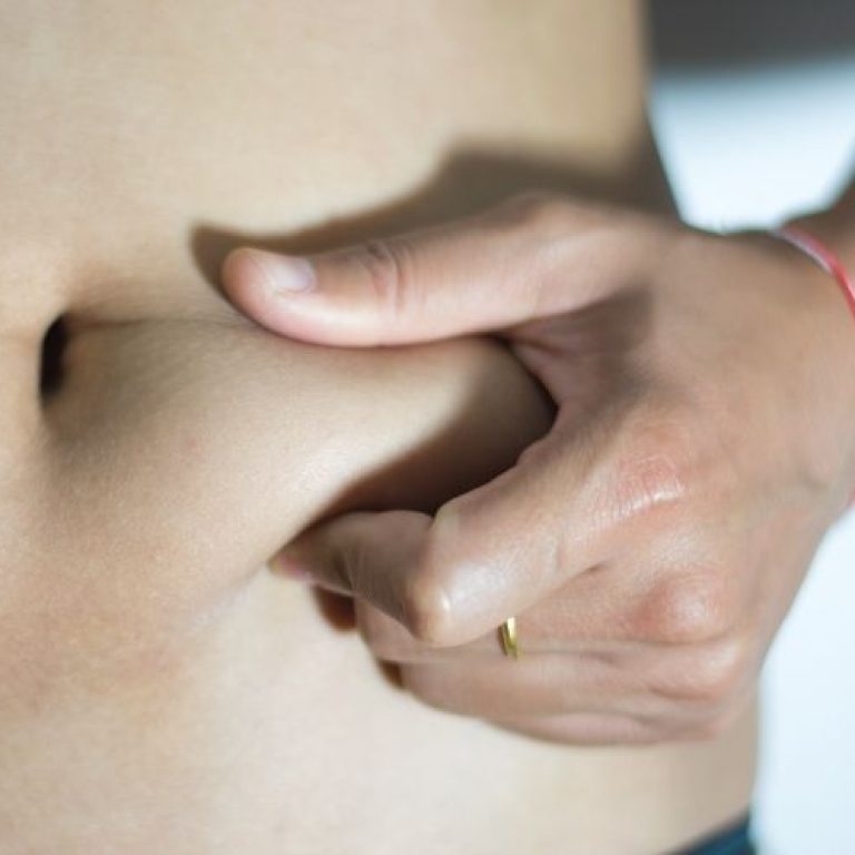 morpheus8 best fat reduction treatment Virginia