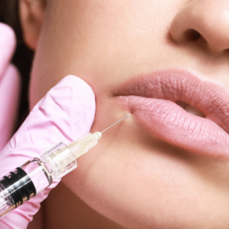 best lip fillers in arlington