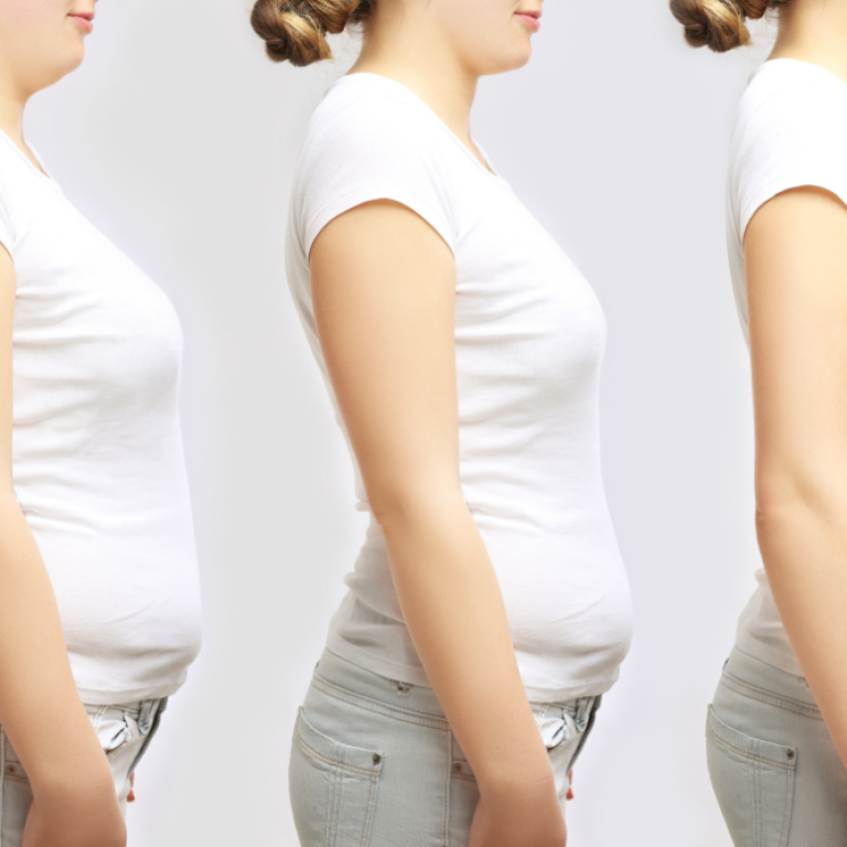 results from the best non-surgical weight loss treatments in Arlington