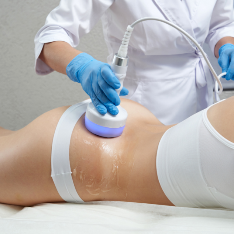 body sculpting services Arlington