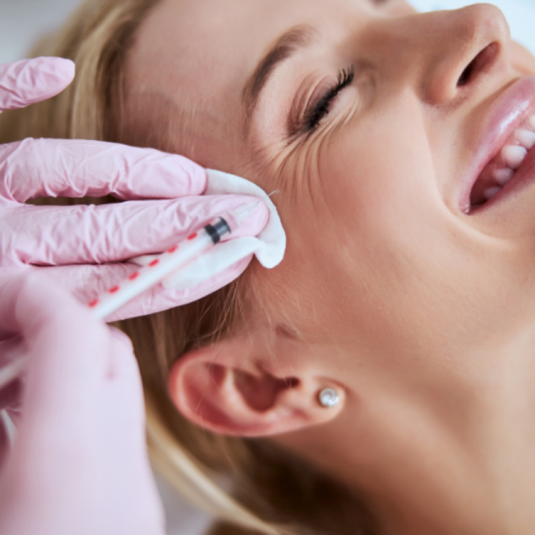 botox for crow's feet