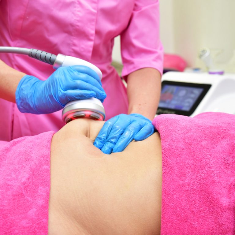 cellulite treatments in Alexandria and Shirlington VA