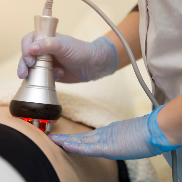 cellulite treatments mclean