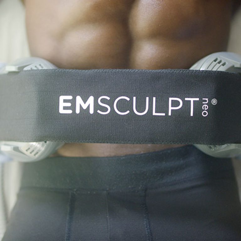 emsculpt near DC now