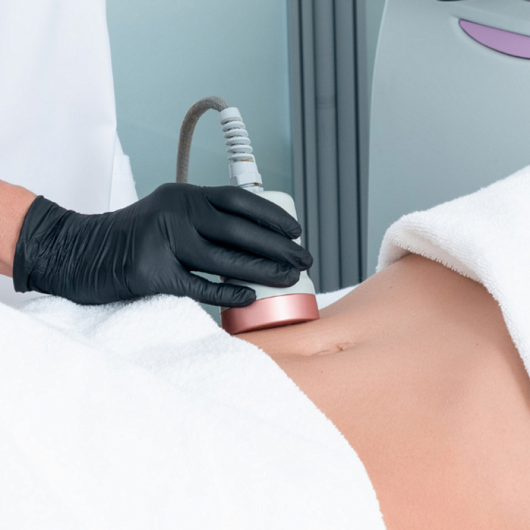 fat reduction without surgery Northern VA