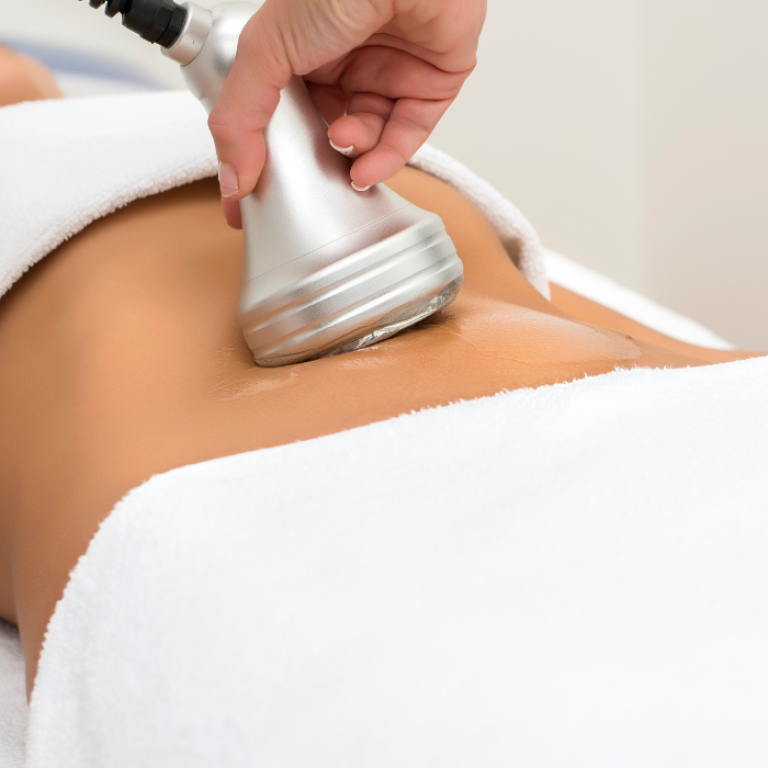 laser lipo Alexandria