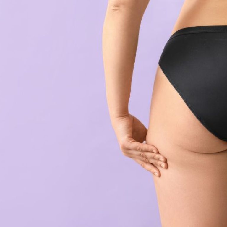 morpheus8 cellulite removal treatment northern virginia