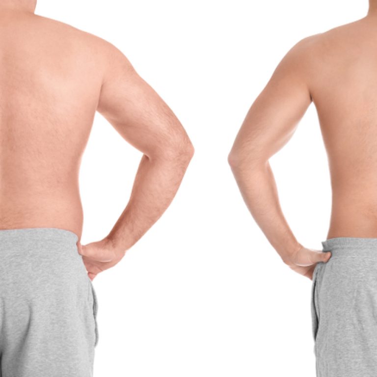 showing off results of Morpheus8 for men in Arlington VA