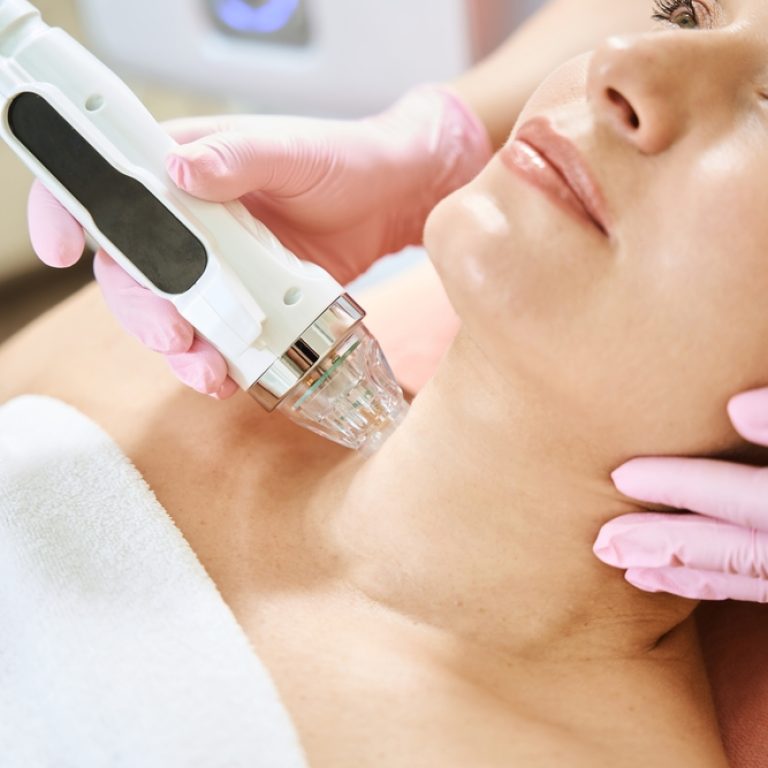 non-surgical neck tightening Arlington VA
