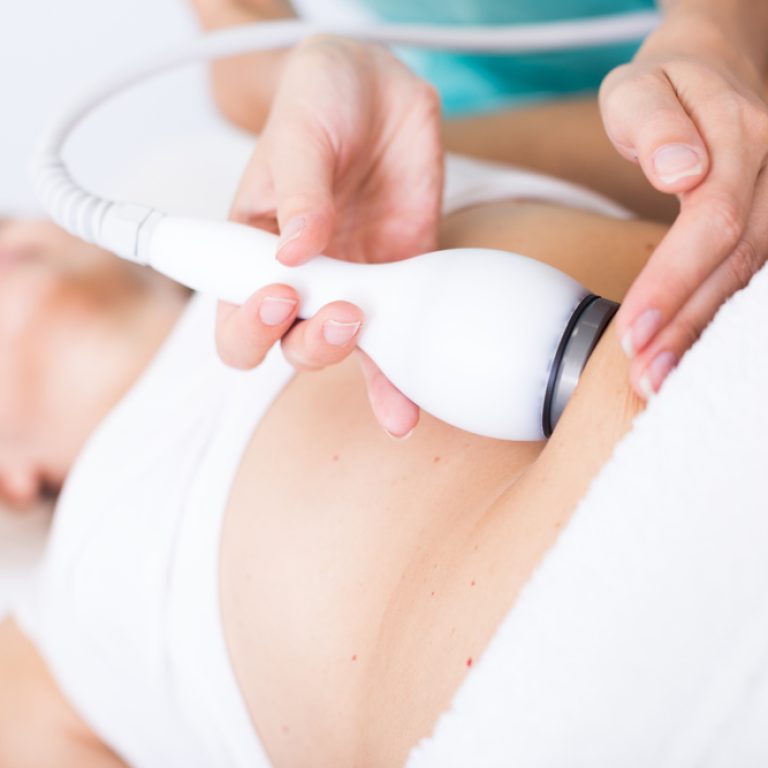 woman getting nonsurgical body sculpting near DC