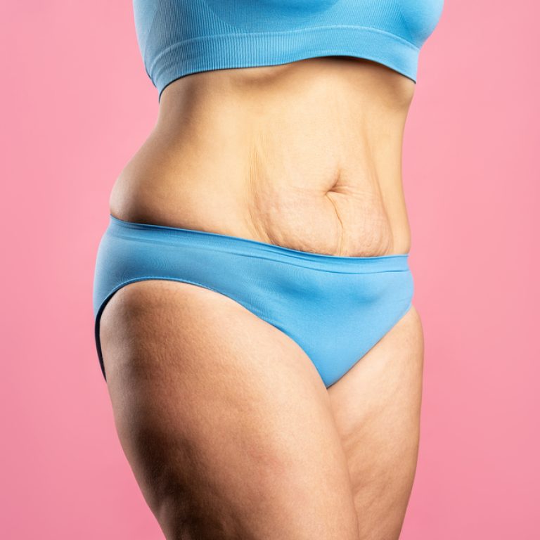 Ozempic body Arlington Virginia