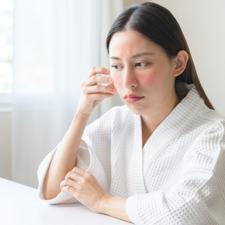 woman in recovery after CoolPeel laser treatment near DC