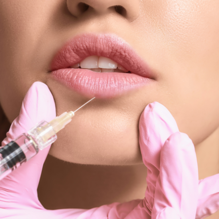 woman getting same-day lip filler in Arlington