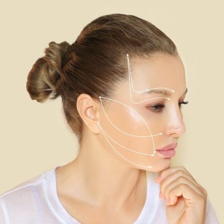 sofwave non-surgical facelift arlington