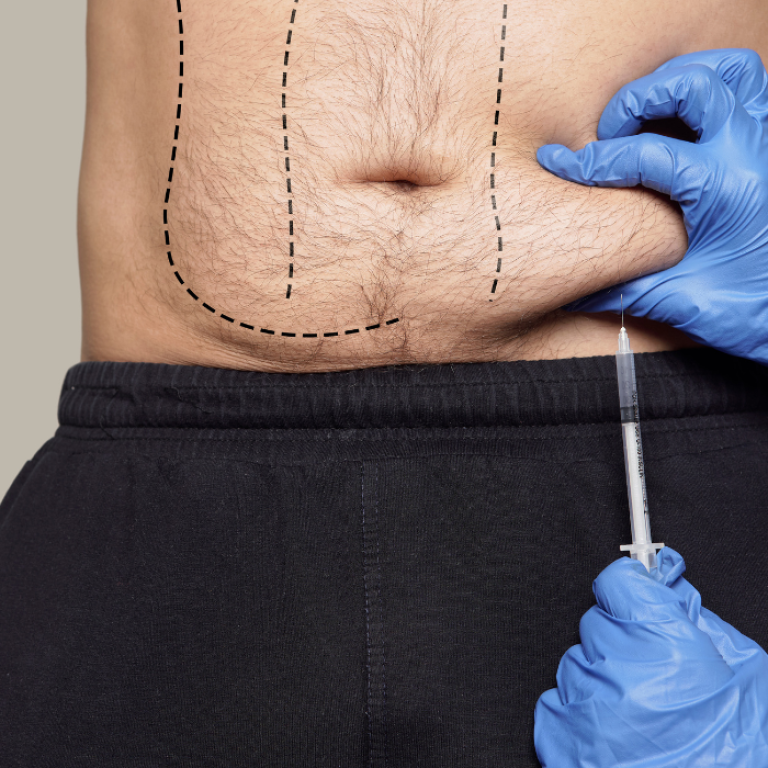 weight loss injections Alexandria