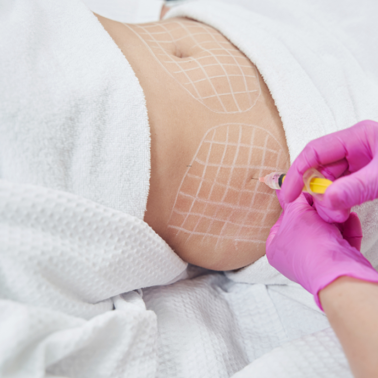 Zepbound doctor providing patient with Tirzepatide injections